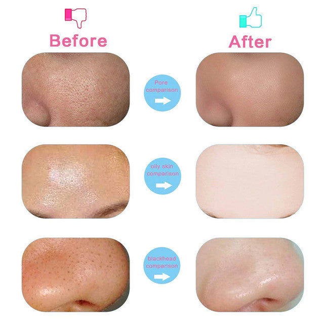 7 in 1 Facial Electric Cleanser and Massager